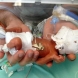 Вижте как изглежда сега, година по-късно, ето това бебе, родено 520 грама
