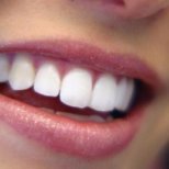 Естествено избелване на зъби