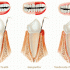 Какво представлява пародонтитът и как се лекува