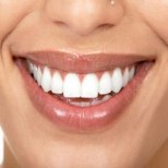 Най-добрите начини да имате бели зъби и здрави венци