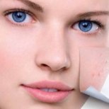 Как да се справите с разширените пори на лицето
