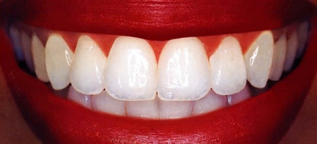 Учени отгледаха зъби в лабораторни условия