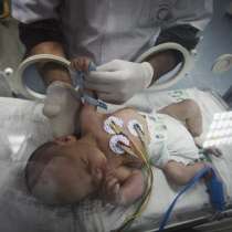 Майка в мозъчна смърт роди живо и здраво бебе