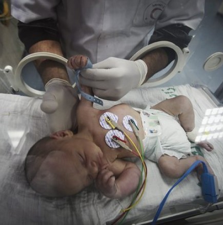 Майка в мозъчна смърт роди живо и здраво бебе