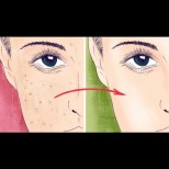 5-те най- добри маски за изравняване на тена и премахване на старческите петна по лицето