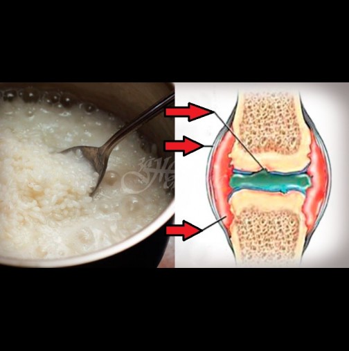Как да използвате ориз за лечение на ставите