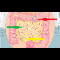 Пречиствате червата си и сваляте 7кг- най- простият начин да сте здрави и слаби