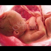 След 7 спонтанни аборта, лекарите карат майка да \