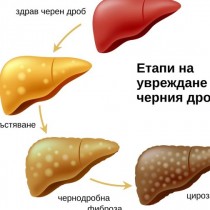 Разкриха най-добрите продукти за възстановяване на черния дроб