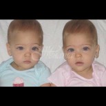 Родени са през 2010 - сега са само на 8, а ги смятат за "най-красивите близнаци в света". Съгласни ли сте?
