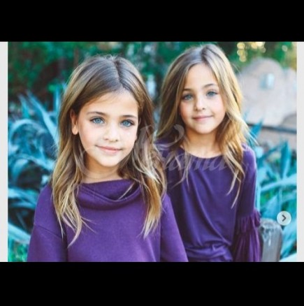 Най-красивите близначки на света покориха мрежата