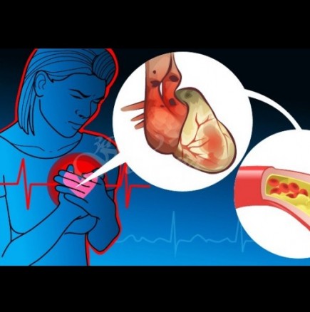 9 опасни симптома на сърдечно заболяване, които не трябва да пренебрегвате