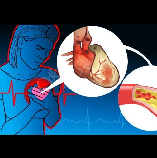 9 опасни симптома на сърдечно заболяване, които не трябва да пренебрегвате