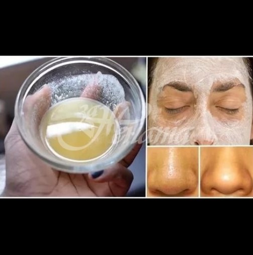 5 домашни маски за лице за мазна кожа, които отпушват порите