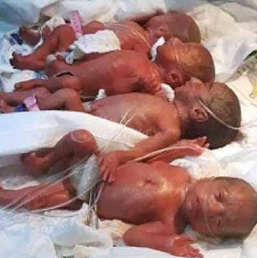Жена роди седемзнаци-6 момичета и едно момче