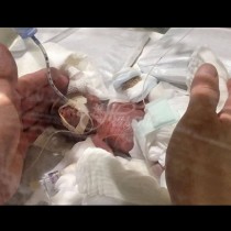 Роди се преждевременно в 24 седмица и тежеше 268 грама - точно две шепи. Ето какво се случва с него днес
