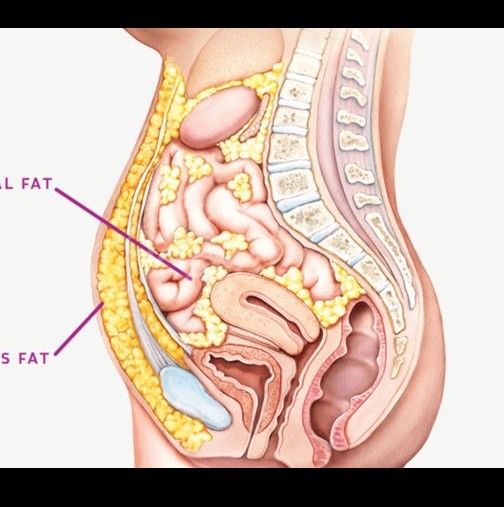 Изключвател на мазнини от коремната област