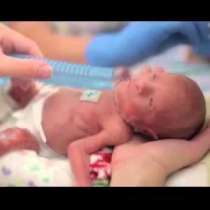 Трогателно видео с борбата за живот на бебе, тежащо 680 гр!
