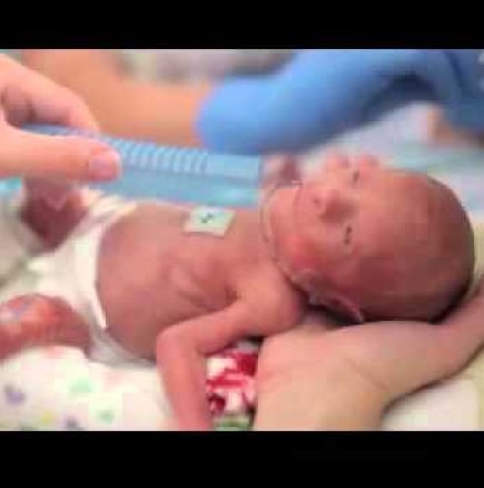 Трогателно видео с борбата за живот на бебе, тежащо 680 гр!