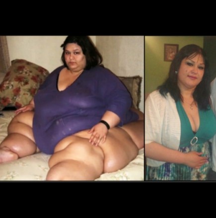 Невероятната история на жена, която успя да отслабне цели 400 кг.!