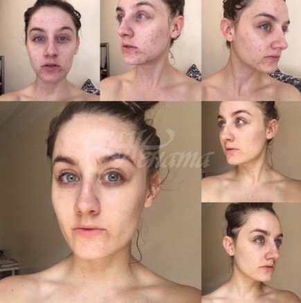 Тя не изми лицето си една година. Ето какво се случи с кожата й след това!