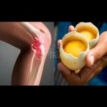 Как с помощта на 2 яйца да премахнем болката в коленете и да "ремонтираме" ставите: