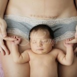 Нещата, които акушерите премълчават за проблемите след раждане секцио