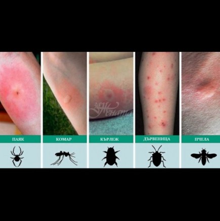 Внимание - лято! 5-те най-често срещани ухапвания от насекоми и какво да правим при всеки от тях: