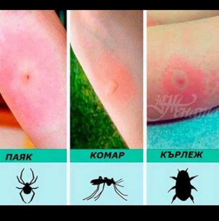 6те най-често срещани ухапвания от насекоми и какво да направите за моментално облекчаване