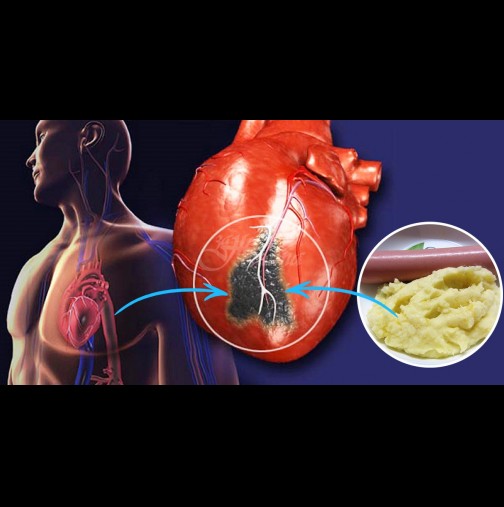 Кардиолозите алармират: погледнете в хладилника си. 4 от 6 инфаркта са пряко свъразани с тези храни