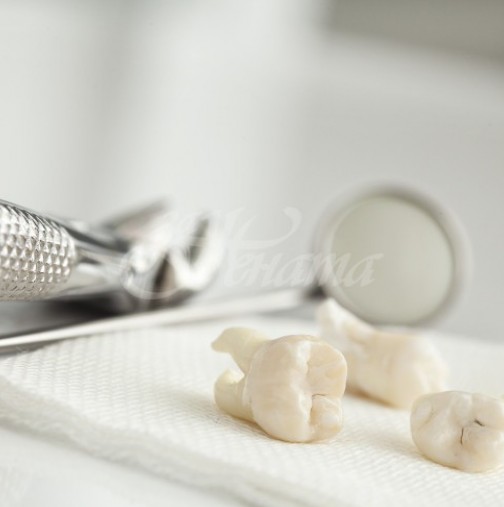 Зъболекар посочи храни, които са вредни за цвета на зъбите и пожълтяват, ако ги ядете