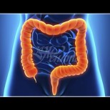 6 тихи симптоми на рак на дебелото черво, които не могат да бъдат пренебрегнати!