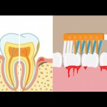 Венците ми кървяха безобразно, чак дъхът ми се беше променил. Добре че зъболекарят ми каза какво да правя в къщи! 