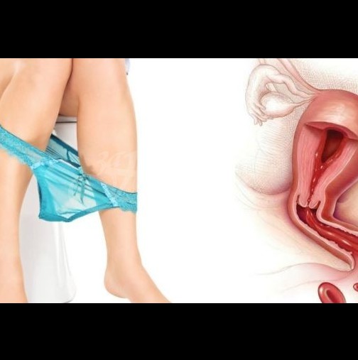Видове вагинално течение-Кога и двамата партньори се нуждаят от лечение, хормонални причини и инфекции