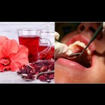 Екзотичната напитка с рубинен цвят е най-големият враг на зъбите ни. Разяжда ги необратимо:
