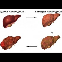 Всеки трети е с увреден черен дроб! Ето кои са първите симптоми за увреждане на черния дроб: