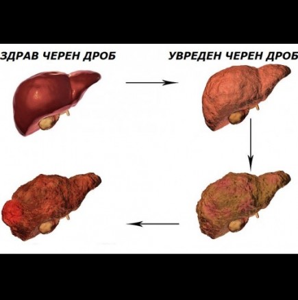 Всеки трети е с увреден черен дроб! Ето кои са първите симптоми за увреждане на черния дроб: