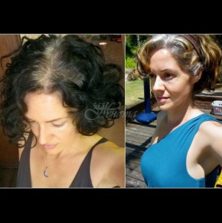 Косата ѝ побелява внезапно за една нощ, когато е само на 21 - ето как изглежда днес, на 44 (Снимки):
