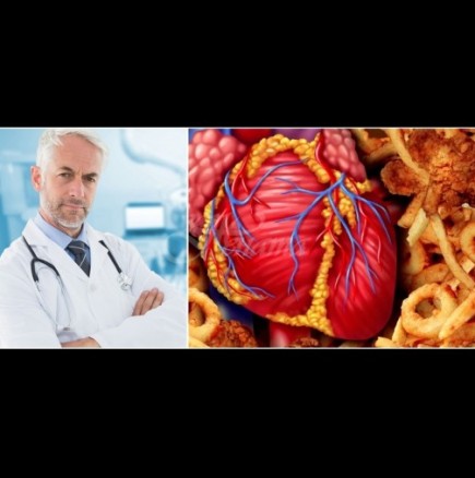 Аз съм кардиолог - ето 9-те опасни храни, които забранявам на близките ми да ядат: