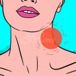 Какви са причините за увеличените лимфни жлези на шията и как да ги лекувате