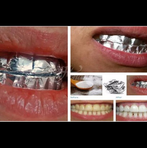 Ето как бързо да избелите зъбите си с алуминиево фолио