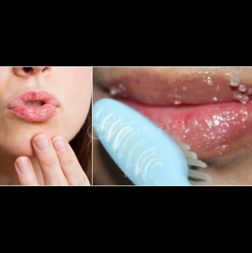 7 бабини лека за напукани и изранени устни - стават меки и гладки като коприна: