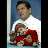 Историята на Малката русалка от Перу просълзи милиони - тази малка кукличка се бори докрай, за да живее (Снимки):
