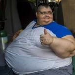 Най-дебелият човек успя да стопи 330 кг и остана с 95 кг излишна кожа-Ето колко тежи вече!