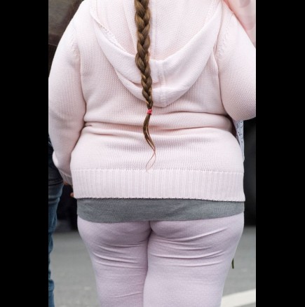 5-годишно момиче, което тежи 63 килограма