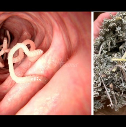 95 % от нас имат паразити, които ни тровят с отрови: Най-лесната рецепта за изчистване-измита ги за 3 дни!