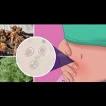 Те рушат тялото на всеки трети човек - 10 тихи симптома на паразити и как да ги изкараме от тялото с билки: