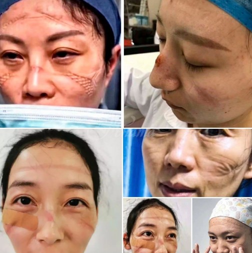 Ето как изглеждат лицата на медици, които борят с коронавируса в Китай в продължение на денонощия без да почиват