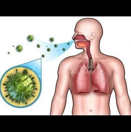 Най-добрите билки и домашни средства при лечение на пневмония:антивирусно, чисти дихателните пътища и помагат отхрачването!