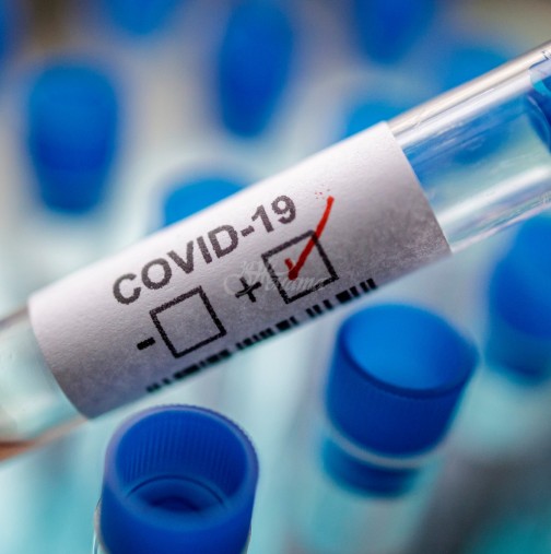 Ето тук може да проверите сами каква е вероятността да умрете от коронавирус